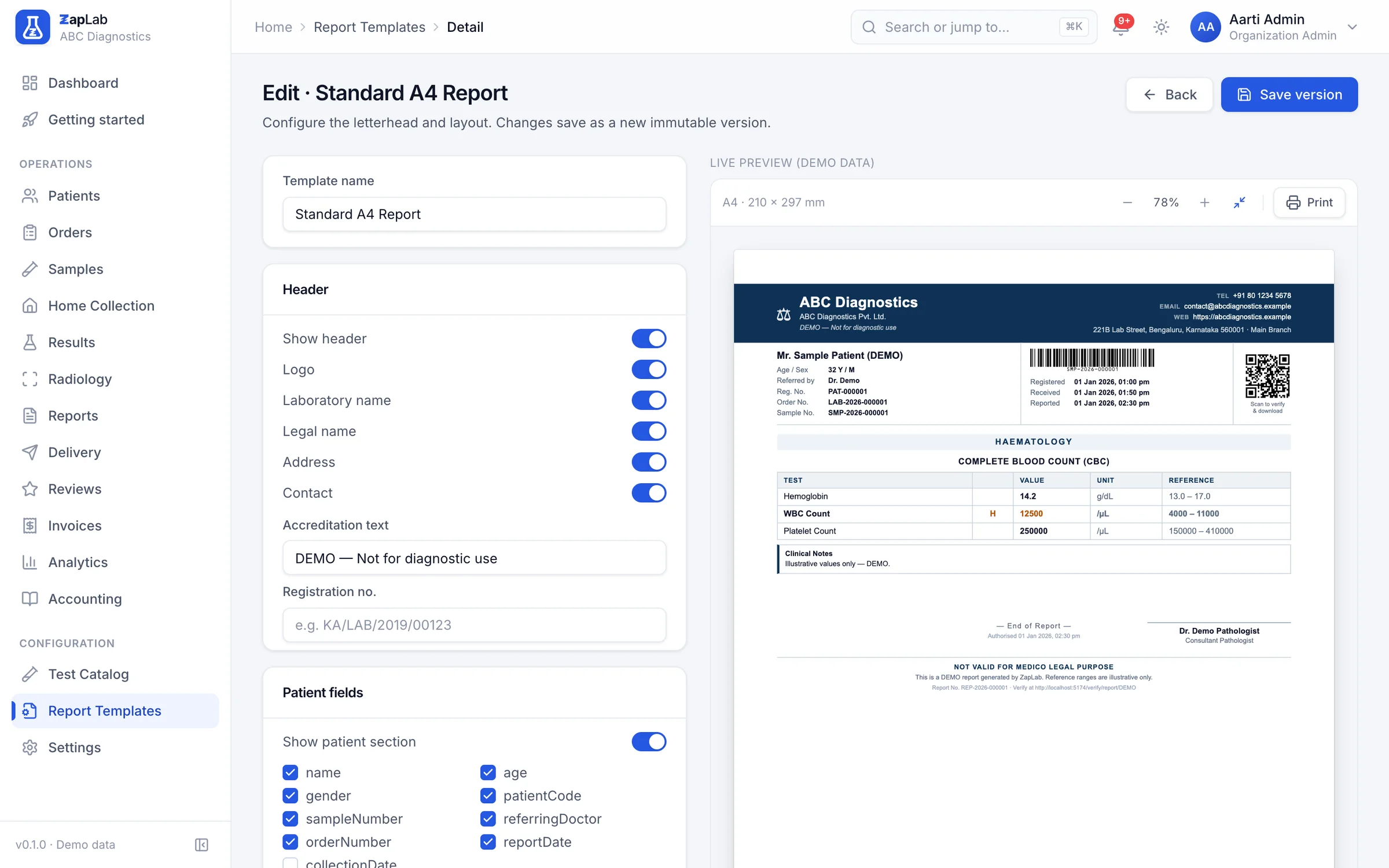 Report template editor with header, accreditation and patient-field settings on the left and a live A4 preview of the report on the right
